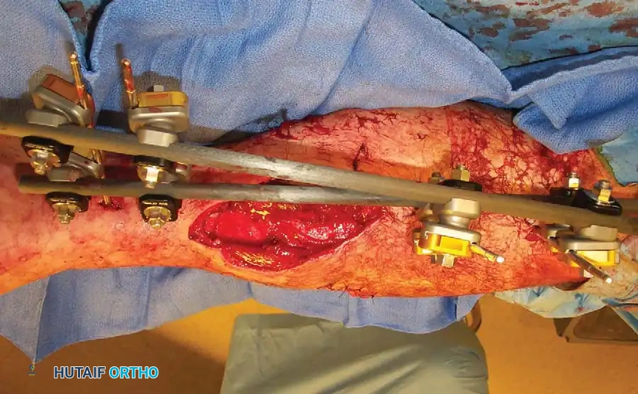 TRAUMA PRINCIPLES Surgical Diagram