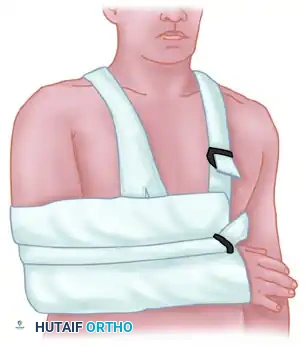 TREATMENT Surgical Diagram
