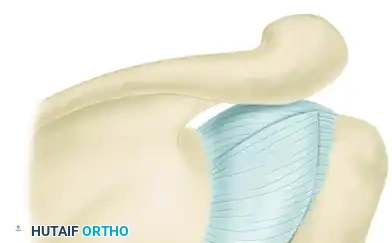 TREATMENT Surgical Diagram