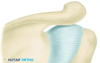 TREATMENT Surgical Diagram