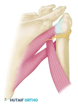 TREATMENT Surgical Diagram