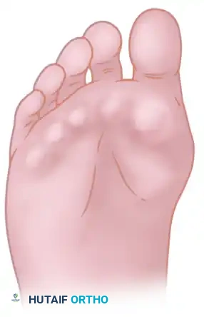 TREATMENT Surgical Diagram