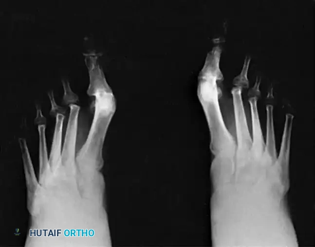 TREATMENT Surgical Diagram
