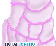 تصنيف أنواع الإصابات في مفصل شاركو