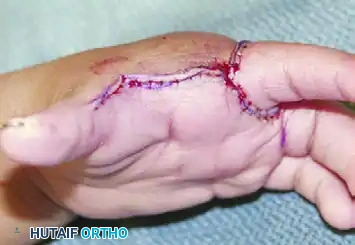 Manske and Halikis Web Types