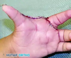 Manske and Halikis Web Types