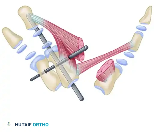 Manske and Halikis Web Types