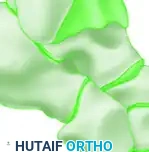 Triple Arthrodesis - Bone Apposition