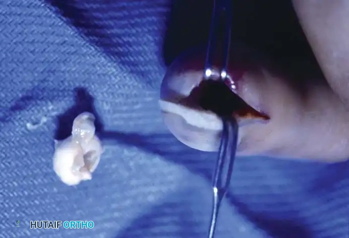Hutaifortho's Orthopaedic Diagram