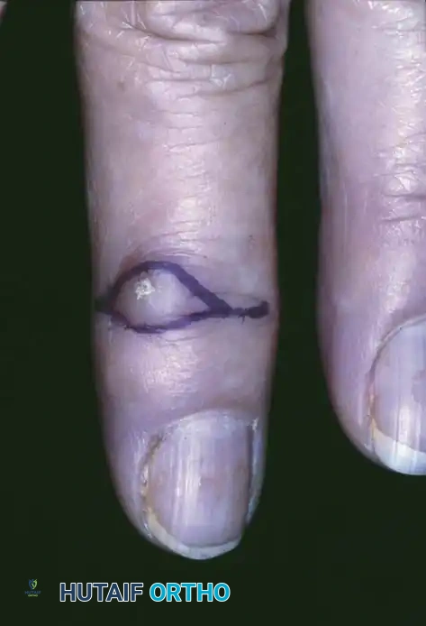 Hutaifortho's Orthopaedic Diagram