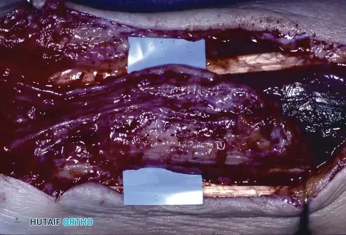 Hutaifortho's Orthopaedic Diagram