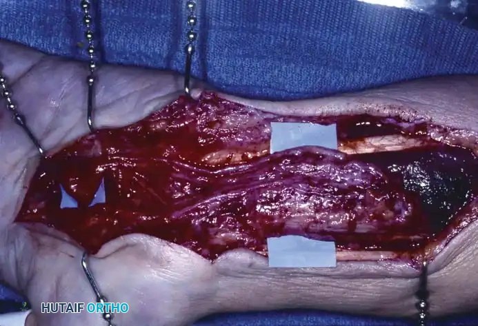 Hutaifortho's Orthopaedic Diagram