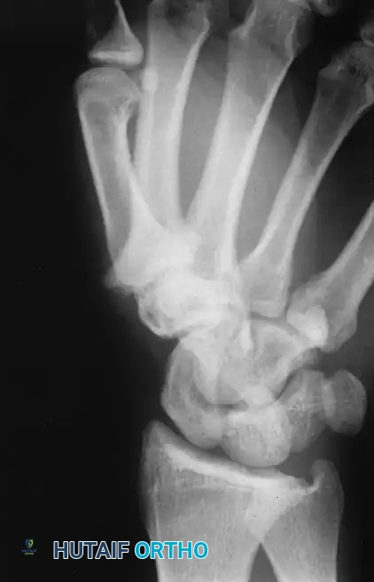 Hutaifortho's Orthopaedic Diagram