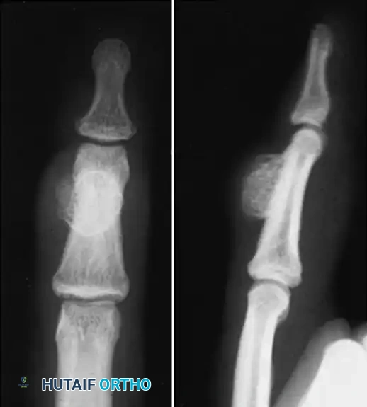 Hutaifortho's Orthopaedic Diagram