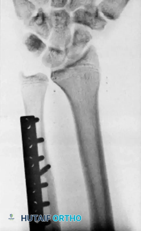 Postoperative Radiograph