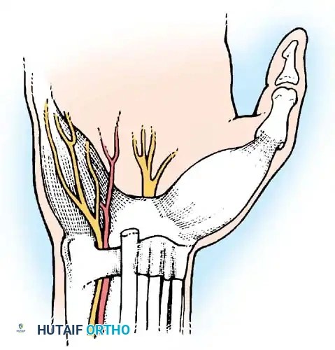 Ulnar Tunnel Syndrome & Stenosing Tenosynovitis Surgery