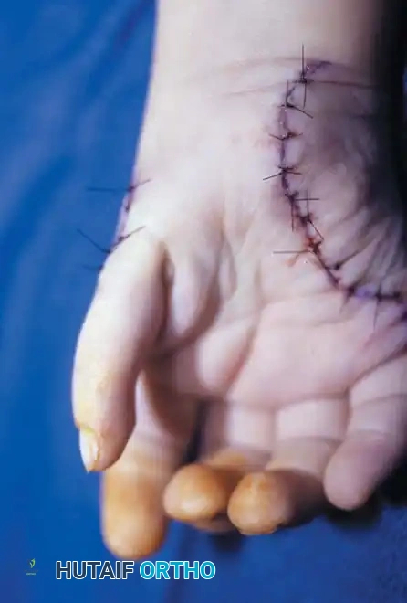 Hutaifortho's Orthopaedic Diagram