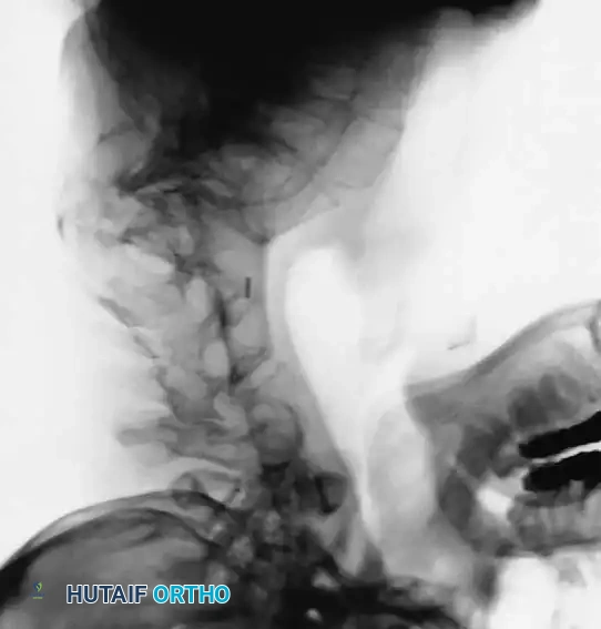 Hutaifortho's Orthopaedic Diagram