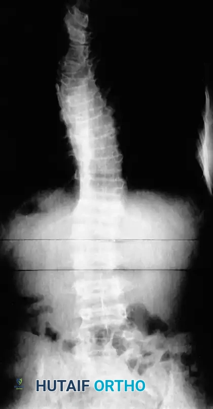 Hutaifortho's Orthopaedic Diagram