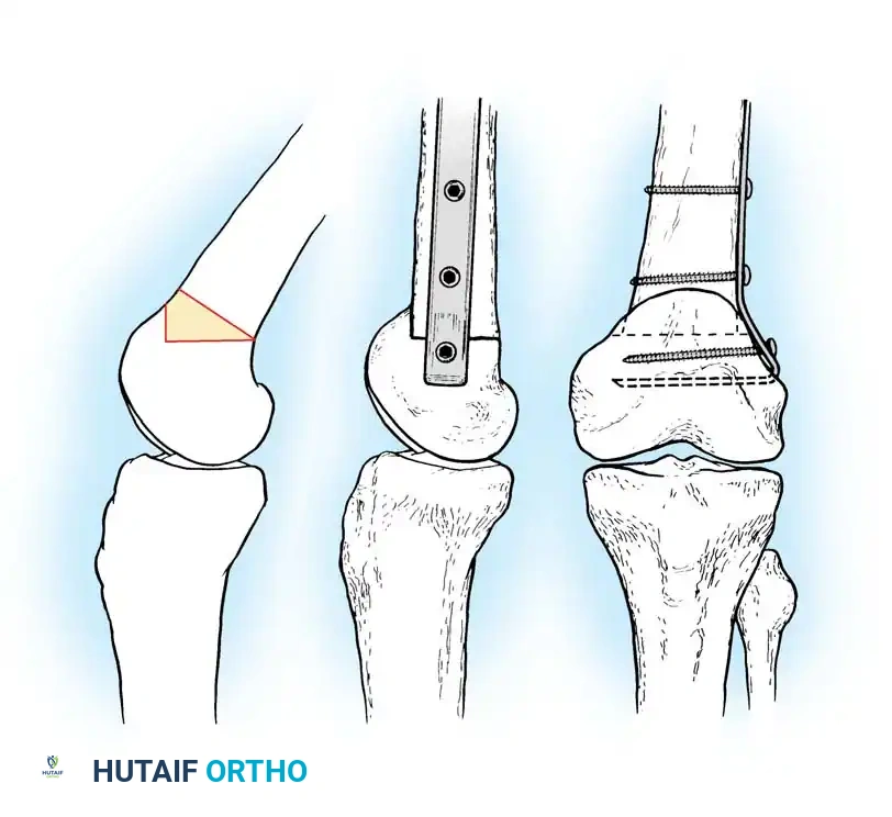 Is Your Wrist Pain Carpal Tunnel Syndrome? Symptoms & Relief Explained