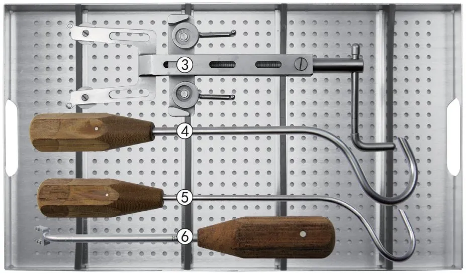 Tension Band Wiring Kit