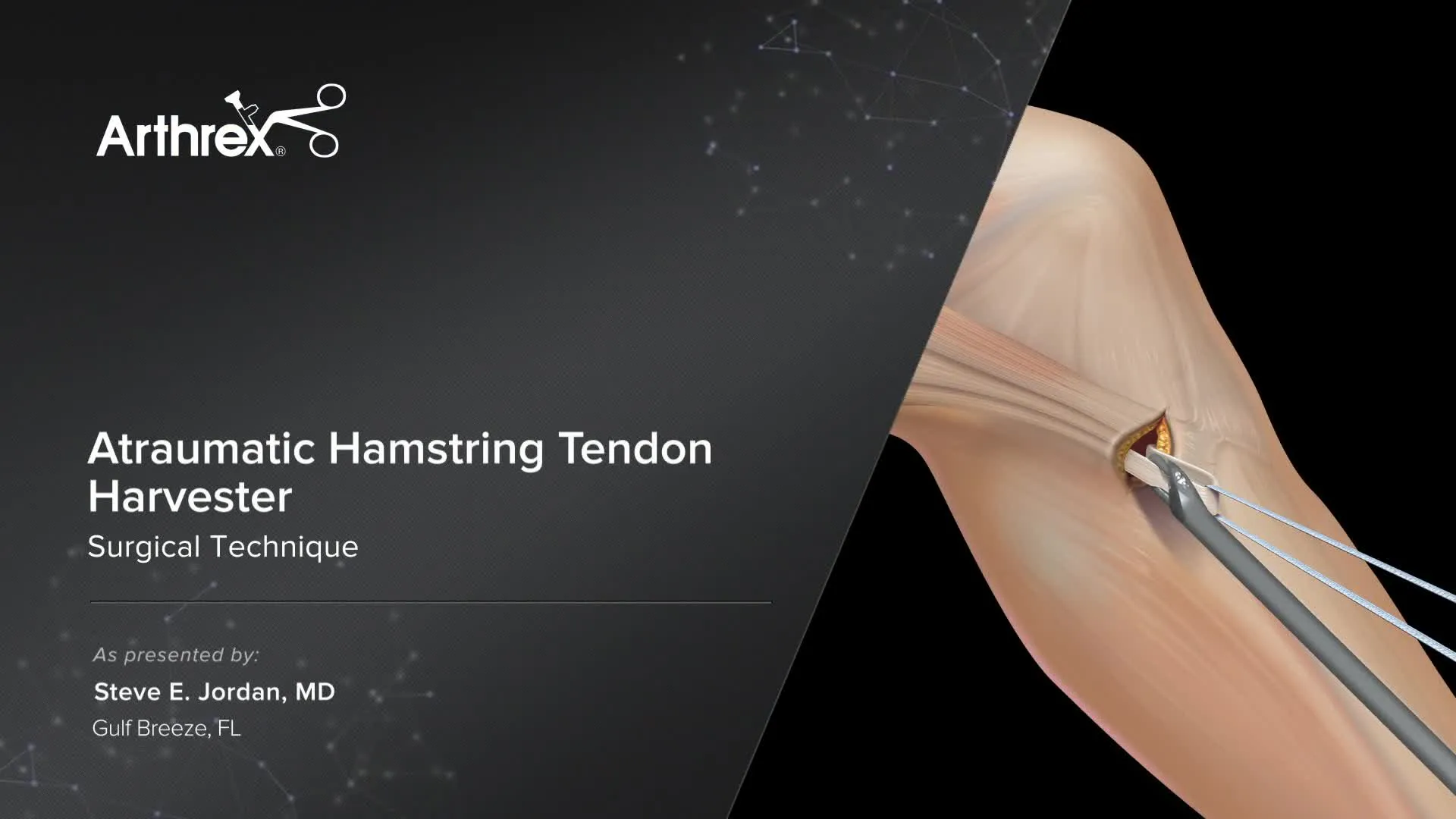 Hamstring Tendon Stripper (Harvester)