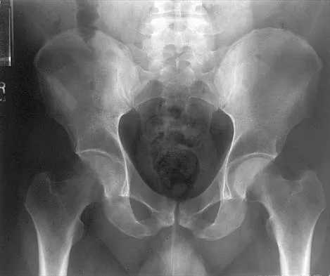 Anatomy 2000 Practice Questions: Set 1 (Solved) - Figure 25