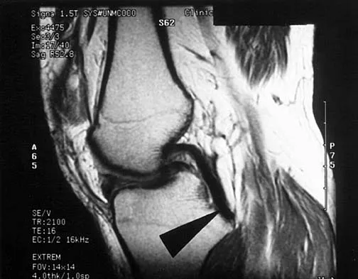 Anatomy 2000 Practice Questions: Set 1 (Solved) - Figure 30