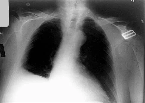Anatomy 2000 Practice Questions: Set 1 (Solved) - Figure 32