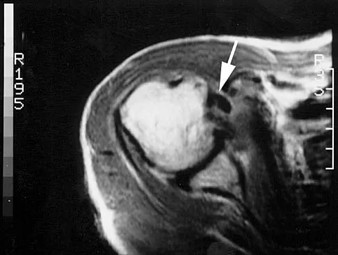 Anatomy Board Review 2000: High-Yield MCQs (Set 2) - Figure 21
