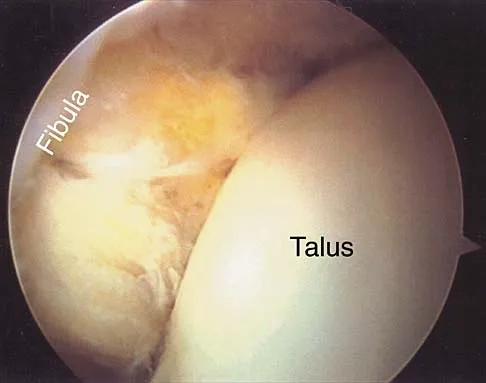 Anatomy Board Review 2000: High-Yield MCQs (Set 2) - Figure 24