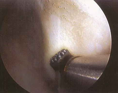 Anatomy Board Review 2000: High-Yield MCQs (Set 2) - Figure 26