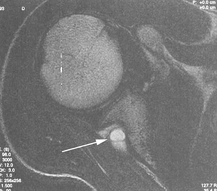 Anatomy Board Review 2000: High-Yield MCQs (Set 2) - Figure 27