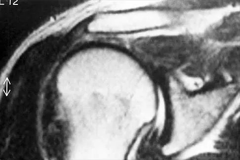 Anatomy Board Review 2000: High-Yield MCQs (Set 2) - Figure 28