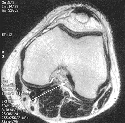 Anatomy Board Review 2000: High-Yield MCQs (Set 2) - Figure 6