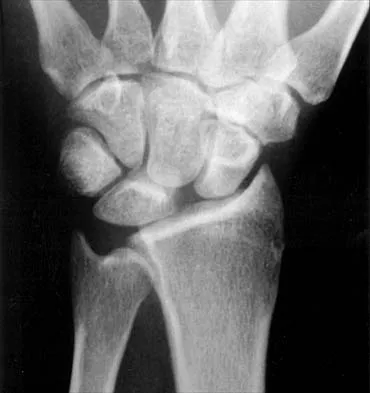 Anatomy Board Review 2000: High-Yield MCQs (Set 2) - Figure 8