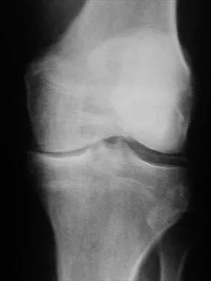 Anatomy 2000 Practice Questions: Set 3 (Solved) - Figure 21