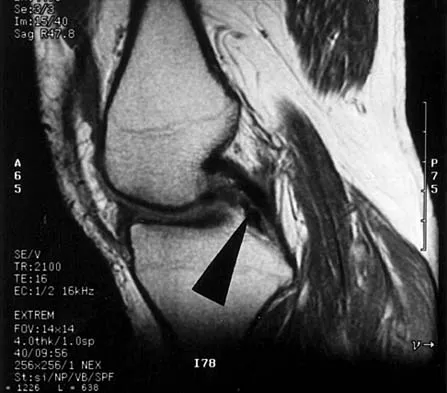 Anatomy Board Review 2000: High-Yield MCQs (Set 4) - Figure 16