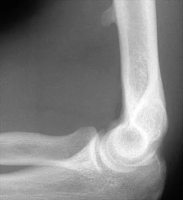 Anatomy 2002 Practice Questions: Set 1 (Solved) - Figure 29