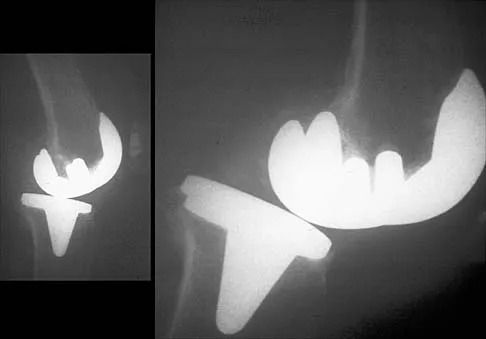 Anatomy Board Review 2002: High-Yield MCQs (Set 2) - Figure 12