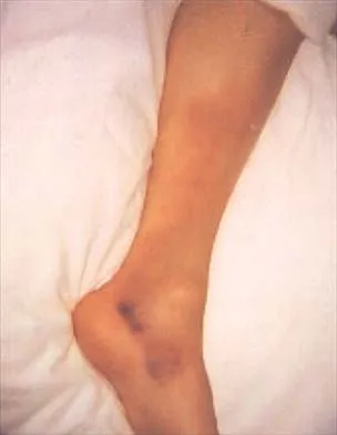 Anatomy Board Review 2002: High-Yield MCQs (Set 2) - Figure 5