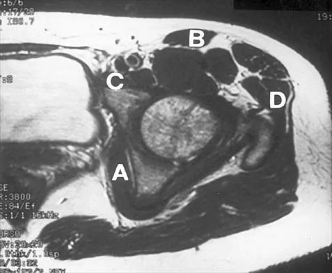 Anatomy 2002 Practice Questions: Set 3 (Solved) - Figure 19