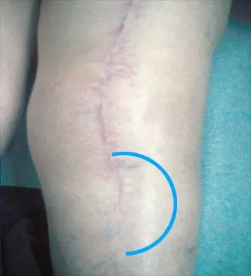 Anatomy 2002 Practice Questions: Set 3 (Solved) - Figure 20