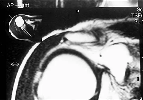 Anatomy Board Review 2002: High-Yield MCQs (Set 4) - Figure 12