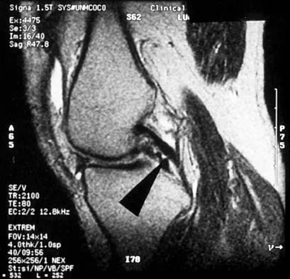Anatomy Board Review 2002: High-Yield MCQs (Set 4) - Figure 17