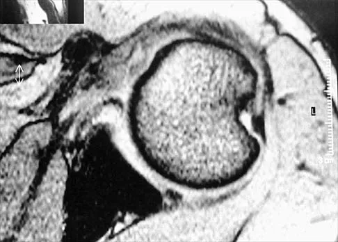 Click to enlarge Anatomy Board Review 2002: High-Yield MCQs (Set 4) - Figure 9