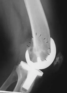 Anatomy 2005 Practice Questions: Set 1 (Solved) - Figure 15