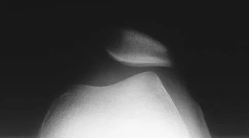 Anatomy 2005 Practice Questions: Set 1 (Solved) - Figure 29