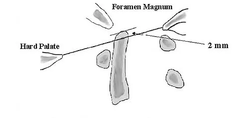 Anatomy 2005 Practice Questions: Set 1 (Solved) - Figure 30