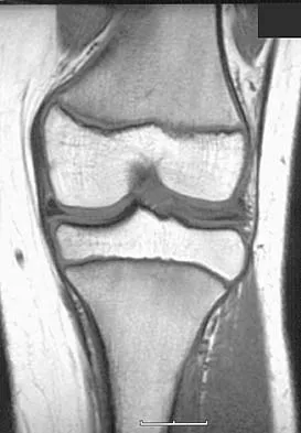 Anatomy Board Review 2005: High-Yield MCQs (Set 2) - Figure 10